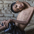 頭部只能掛胸前的印度男孩8個月前才手術成功正著看世界，現在他去世了…