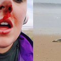 遛狗女主人在沙灘上阻止屁孩虐待擱淺海豹，不料慘遭打臉而狂流鼻血…故事一流傳後引起網友怒火！ 