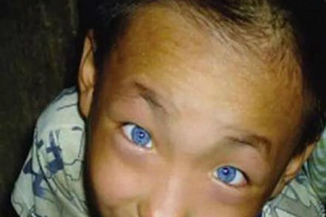 廣西男童天生長藍色眼睛 藍眼睛具有夜視功能似貓眼