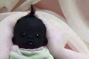 這個「全世界最黑的寶寶」2歲照曝光了，但許多網友看了眉頭一皺…