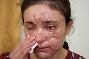 18歲的女孩慘遭ISIS綁架淪為「祭品」！每天被不一樣的人輪暴！逃脫後她說出「一句話」…震撼全世界！ 