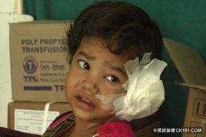 畫面駭人！印度4歲女童左耳劇痛 就醫後竟在耳內發現「這東西」網：看完我要吐了 