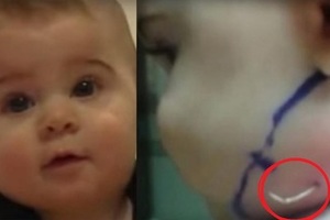 媽媽發現7個月大寶寶臉上竟然長了一根「白色尖角」！檢查發現「真相」連醫生都被嚇壞了！
