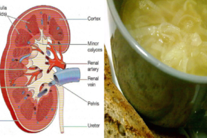 腎乾淨，人就年輕！每天來杯「洋蔥湯」排出廢物、預防泌尿道感染，讓你的腎煥然一新。