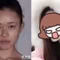 她就是「花百萬也要整成Angelababy」的強國女人，超扯的整形日記一曝光就讓大家看傻了眼！