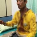 阻潛水客非法打魚！澎湖保育志工遭「手電筒5下爆頭」　衣服全染紅