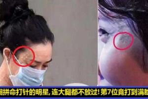 明星為了美什麼針都亂打！鍾麗緹打到滿臉都是針孔，溫碧霞打抗衰老針，第7位居然打到滿臉是血，太可怕了！