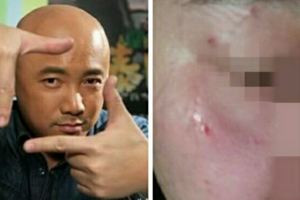 徐崢毆打女記者轟動娛樂圈目擊者透漏行為暴力連踹記者面部三腳