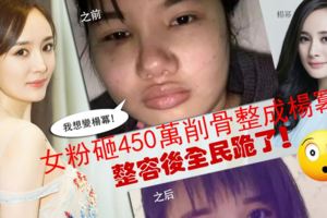 我想變楊冪！女粉砸450萬削骨整成楊冪!整容後全民跪了！