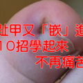 腳趾甲又「嵌」進肉裡，讓你痛苦不已嗎？快把這１０個妙招學起來，以後再也不擔心了！