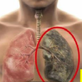 出現胸悶、咳嗽....這五大症狀，可能是肺衰竭的前兆，這一物可以掃除肺部垃圾，被稱為「肺部清潔工 」 ，一定要多吃！