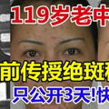 119歲老中醫臨死前傳授絕斑秘方!只公開3天!快收藏! 