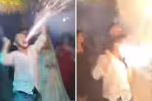 男子用嘴叼煙火熱舞　貼臉爆炸下場曝