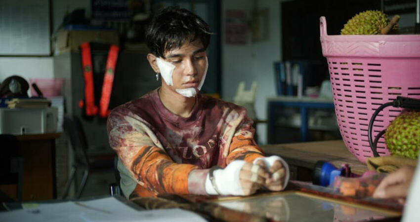 男星驚傳出意外！遭「榴槤」砸傷 頭部出血昏厥急送醫