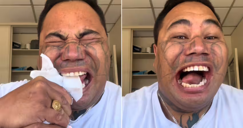 看牙醫太貴！男子自行拔牙　對鏡頭微笑「曬出牙齒」
