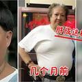 洪金寶近照曝光！前陣子剛動完手術，如今出入都要靠拐杖！現在還胖成這樣！網友：洪金寶真的老了！