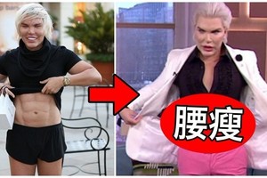 真人肯尼「不滿意88萬人工腹肌」再打掉4根肋骨！大秀最新「20吋腰比女人還細」又嚇壞網友！