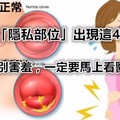 女人的「隱私部位」出現這4種癥狀，千萬別害羞，一定要馬上看醫生！