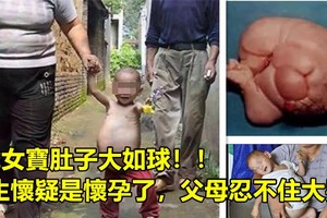 1歲女寶肚子大如球，醫生懷疑是懷孕了，父母忍不住大哭！