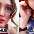 人氣網紅消失數月「整成外星人」眼睛爆凸！粉絲一看心碎「以前明明超美」怒轟：蛇精女！