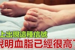 腿上出現這種信號，說明血脂已經很高了，別太晚知道了... 