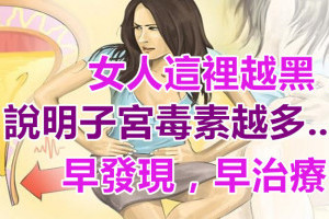 女人「這裡」越黑，說明子宮毒素越多，99%的女人都不知道......早發現早治療！