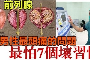 男性「前列腺」最怕7個壞習慣！快告訴家裡男人，千萬不要再犯了！！