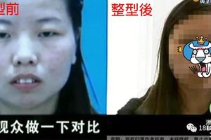 大陸女子豪砸15萬整形…術後堅決不付錢！網友一看「前後對比圖」全笑噴：不付錢 是對的