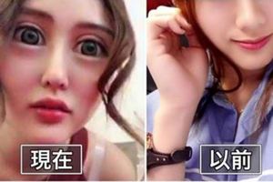 人氣網紅消失數月「整成外星人」眼睛爆凸！粉絲一看心碎「以前明明超美」怒轟：蛇精女！