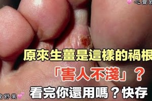 原來生薑是這樣的禍根？「害人不淺」，看完你還用嗎？快存！