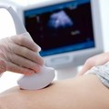 孕婦健康：懷孕早期應該要做什麼事？