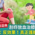 刮痧放血治膝痛？骨科醫：反效果！真正護膝2重點