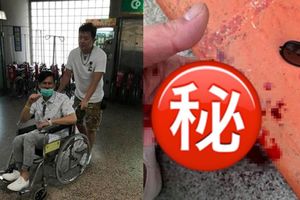 慎入！馬國賢驚爆出車禍 血流不止緊急送醫