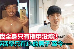 被死神選上的癌症末期病患 壯男：我全身只有指甲沒癌 