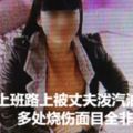 女子上班路上被丈夫潑汽油點火多處燒傷面目全非