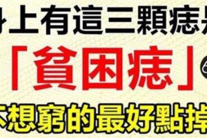 身上有這3顆痣是「貧困痣」不想窮,最好點掉