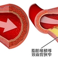 老中醫教您清理血管不吃藥不花錢太妙了，能讓血管更年輕、更健康！