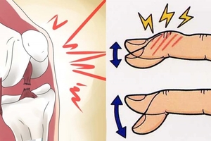 膝蓋、脖子、手指關節「嘎嘎響」是因為有病？真相太驚人了....不看後悔到下輩子阿！