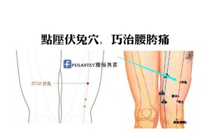 點壓伏兔穴，巧治腰胯痛