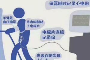 跑步機上的檢查：心電圖平板負荷試驗