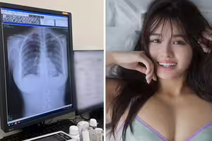 寫真偶像炫耀「我的肺很乾淨！」　網看X光全歪樓：太刺激了