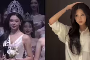 父親是男神!23歲最美星二代奪選美冠軍 遭挖「童年舊照」網愣:該頒獎給整形醫生 父親是男神!23歲最美星二代奪選美冠軍 遭挖「童年舊照」網愣:該頒獎給整形醫生