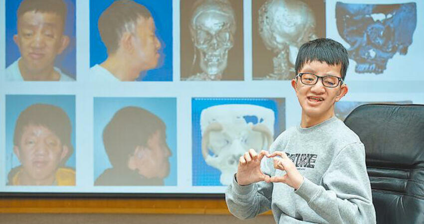 臉縮眼凸被笑外星人 20次手術重生