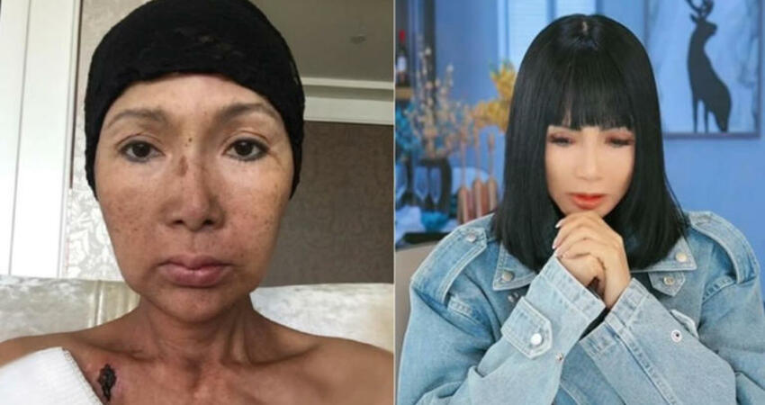 59歲女星3癌症纏身！為續命「切半個舌頭」 露面曝最新近況