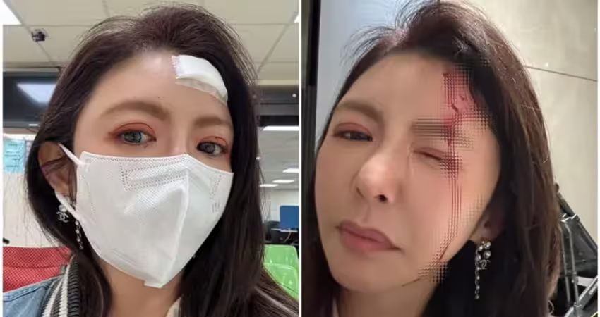 前主播跑趴出事了！曝「頭殼破一孔」驚悚流血照 罪魁禍首竟是老公
