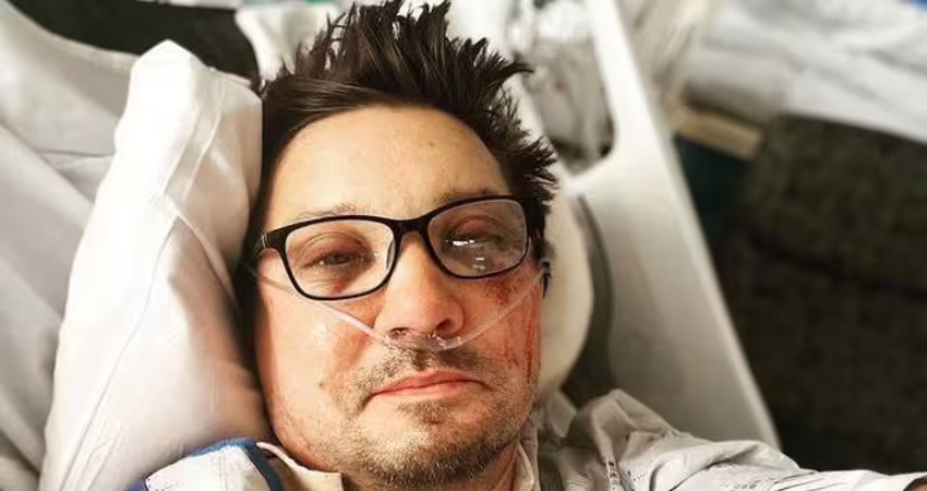 左眼從頭顱爆出！大咖男星「遭剷雪車重輾」 30根骨頭斷裂傷況曝光