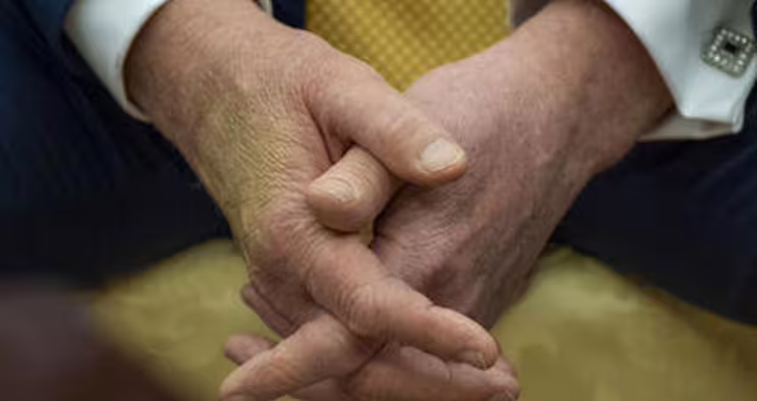 川普雙腿腫脹、疑手背瘀青 化妝遮掩照曝光！白宮緊急解釋真相