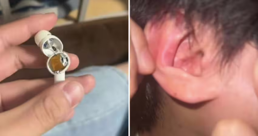 戴中國熱銷藍牙耳機　突在男大生耳內爆炸！專家揭真相了