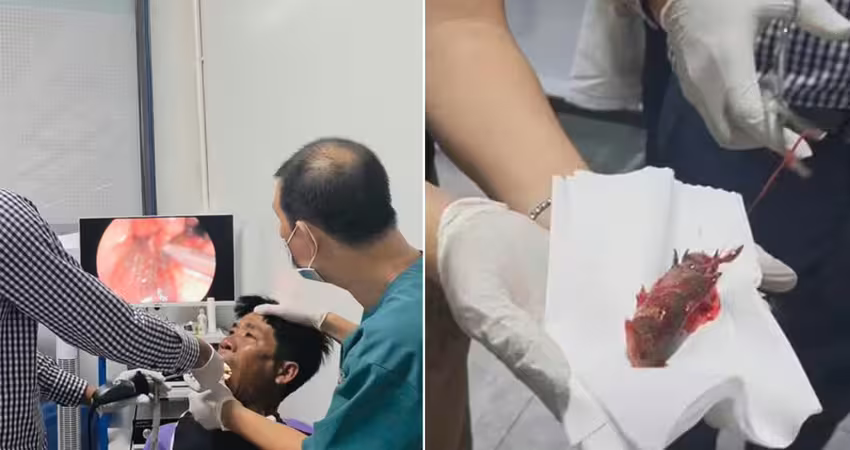 活魚卡在喉嚨裡　男緊急送醫慘了