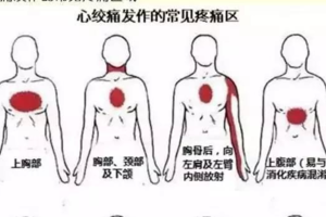 最近在網絡上瘋傳的心髒病自救法，到底是真是假？給你最權威的解讀，分享出去吧！